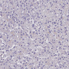 Immunohistochemical staining of human liver shows no positivity in hepatocytes as expected.