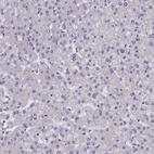 Immunohistochemical staining of human liver shows no positivity in hepatocytes as expected.