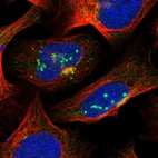 Immunofluorescent staining of human cell line U-2 OS shows localization to nucleoli, cytosol & the Golgi apparatus.