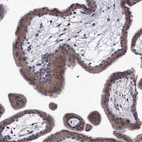 Anti-B4GALT7 Antibody