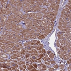 Immunohistochemical staining of human heart muscle shows moderate cytoplasmic positivity in myocytes.