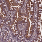 Immunohistochemical staining of human small intestine shows moderate cytoplasmic positivity in glandular cells.