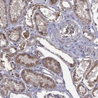 Immunohistochemical staining of human kidney shows moderate granular cytoplasmic positivity in cells in tubules.