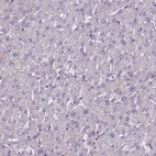 Immunohistochemical staining of human liver shows very weak cytoplasmic positivity in hepatocytes.