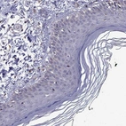 Immunohistochemical staining of human skin shows no positivity in squamous epithelial cells as expected.