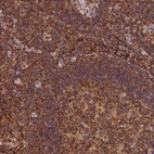 Anti-STOML1 Antibody