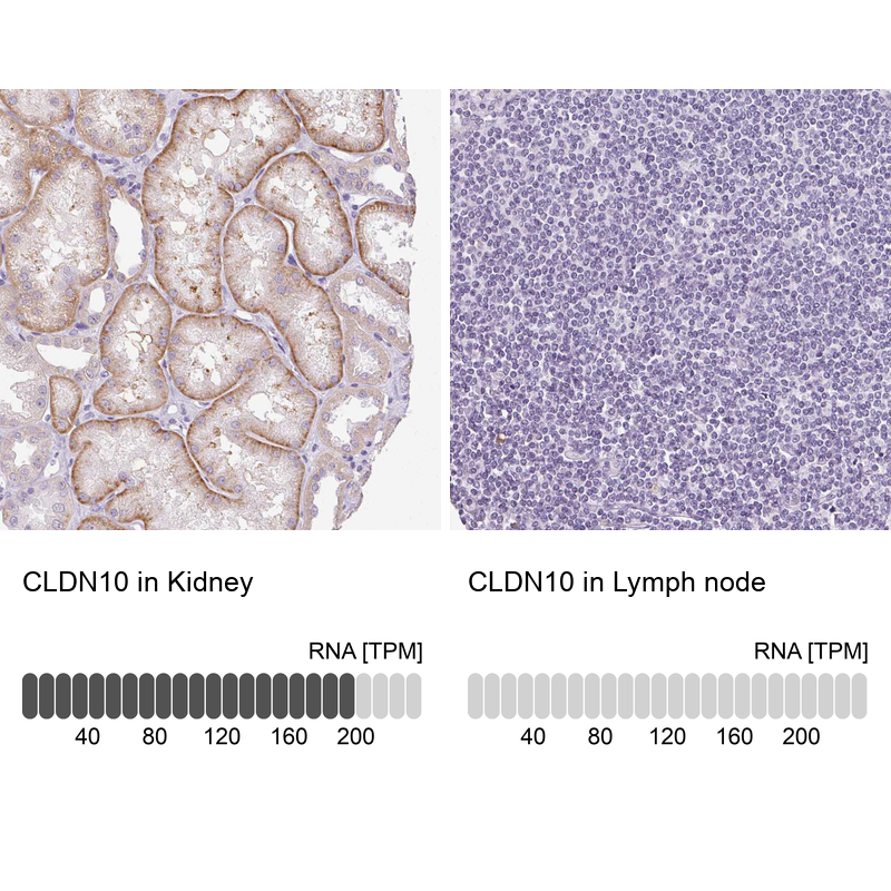 Anti-CLDN10 Antibody