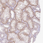 Immunohistochemical staining of human kidney shows moderate membranous positivity in cells in tubules.