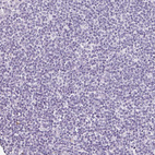Anti-CLDN10 Antibody