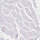 Immunohistochemical staining of human skeletal muscle shows no positivity in myocytes as expected.