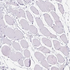Immunohistochemical staining of human skeletal muscle shows no positivity in myocytes as expected.
