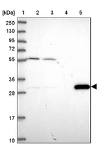 Lane 1: Marker [kDa] 250, 130, 95, 72, 55, 36, 28, 17, 10_br/_Lane 2: Human cell line RT-4_br/_Lane 3: Human cell line U-251MG sp_br/_Lane 4: Human plasma (IgG/HSA depleted)_br/_Lane 5: Human liver tissue