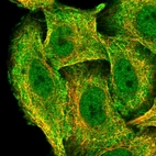 Immunofluorescent staining of human cell line A549 shows localization to nucleoplasm, plasma membrane & cytosol.