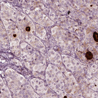 Anti-MIA Antibody