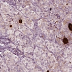 Anti-MIA Antibody