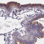 Anti-TMEM138 Antibody