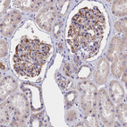 Immunohistochemical staining of human kidney shows strong membranous and cytoplasmic positivity in cells in glomeruli.