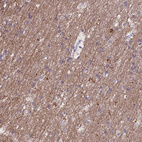 Immunohistochemical staining of human cerebral cortex shows moderate cytoplasmic positivity in neuropil.