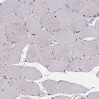 Immunohistochemical staining of human skeletal muscle shows very weak positivity in myocytes.
