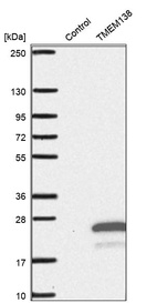 Western blot analysis in control (vector only transfected HEK293T lysate) and TMEM138 over-expression lysate (Co-expressed with a C-terminal myc-DDK tag (~3.1 kDa) in mammalian HEK293T cells, LY413965).