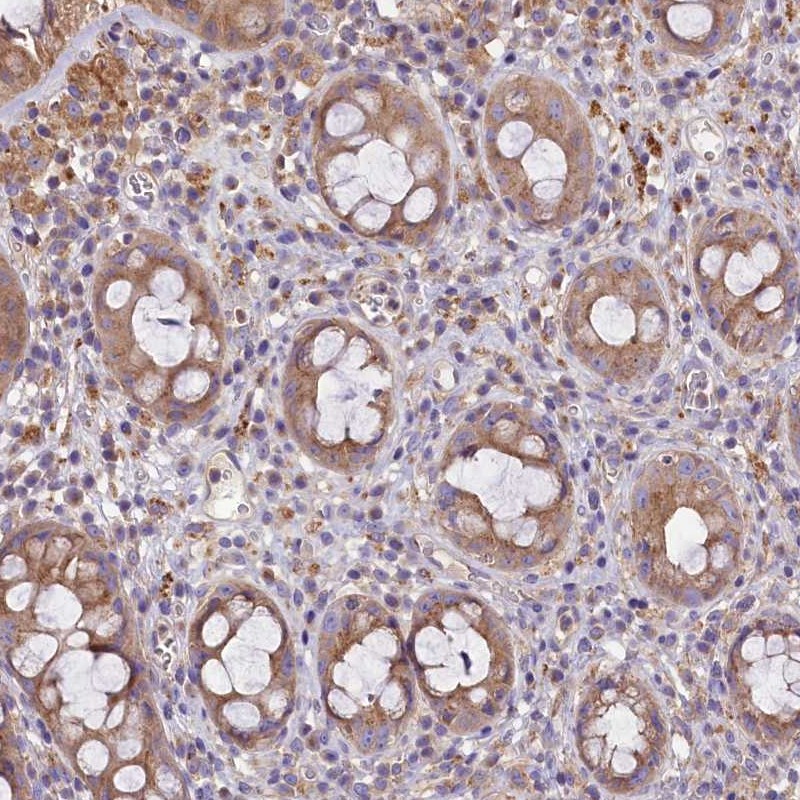 Anti-PEMT Antibody