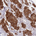 Anti-SLC39A6 Antibody