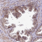 Immunohistochemical staining of human prostate shows moderate membranous positivity in glandular cells.
