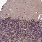 Anti-SLC39A6 Antibody