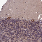 Immunohistochemical staining of human cerebellum shows strong cytoplasmic positivity in Purkinje cells.