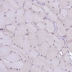 Immunohistochemical staining of human skeletal muscle shows low positivity in myocytes as expected.