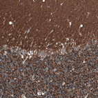 Immunohistochemical staining of human cerebellum shows strong positivity in neuropil.