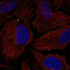 Anti-TMEM198 Antibody