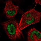 Immunofluorescent staining of human cell line U-251 MG shows localization to nucleoplasm.