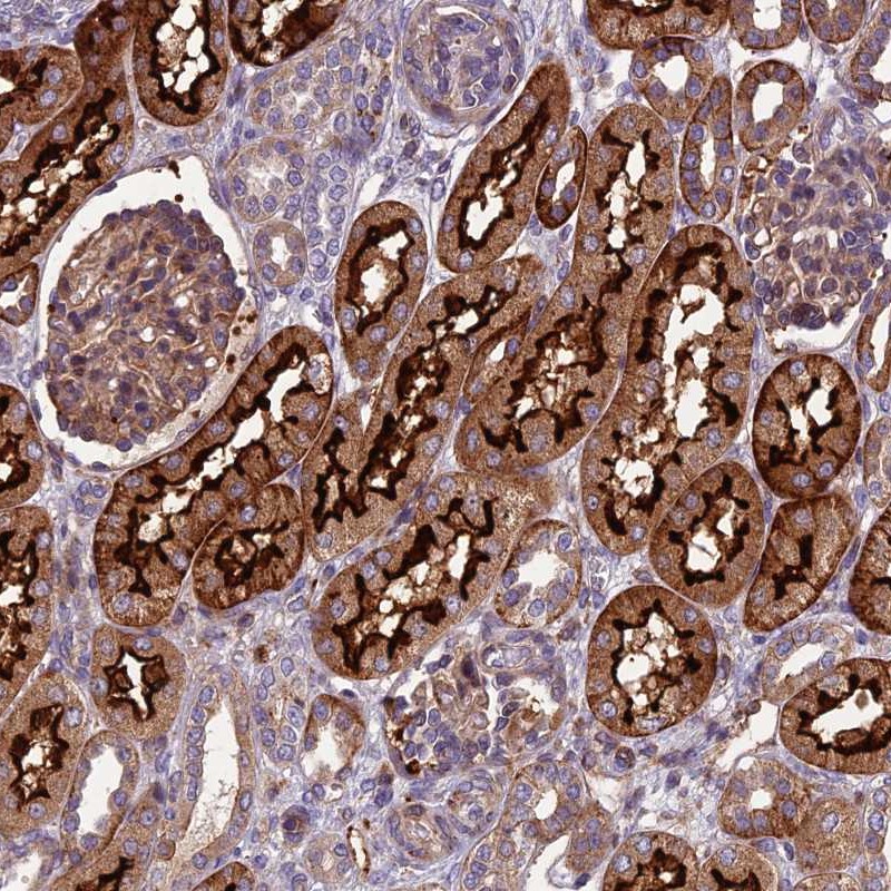 Anti-ARSK Antibody