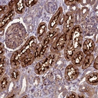 Anti-ARSK Antibody