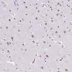 Immunohistochemical staining of human cerebral cortex shows moderate nuclear positivity in neurons.