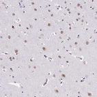 Immunohistochemical staining of human cerebral cortex shows moderate nuclear positivity in neurons.