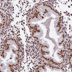 Immunohistochemical staining of human endometrium shows moderate nuclear positivity in glandular cells.