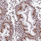 Anti-SBNO1 Antibody
