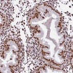 Immunohistochemical staining of human endometrium shows moderate nuclear positivity in glandular cells.