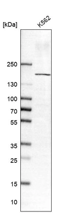 Western blot analysis in human cell line K562.