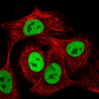 Immunofluorescent staining of human cell line A549 shows localization to nucleoplasm.