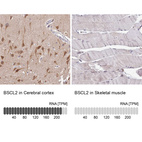 Anti-BSCL2 Antibody