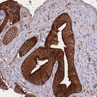 Anti-PLD1 Antibody