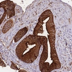 Immunohistochemical staining of human gallbladder shows strong cytoplasmic positivity in glandular cells.