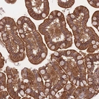Immunohistochemical staining of human small intestine shows strong cytoplasmic positivity in glandular cells.