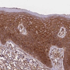 Immunohistochemical staining of human skin shows strong cytoplasmic positivity in squamous epithelial cells.
