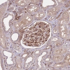 Immunohistochemical staining of human kidney shows moderate cytoplasmic positivity in cells in glomeruli.