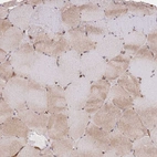 Immunohistochemical staining of human skeletal muscle shows weak cytoplasmic positivity in myocytes.