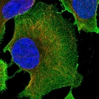 Immunofluorescent staining of human cell line U-2 OS shows localization to plasma membrane.